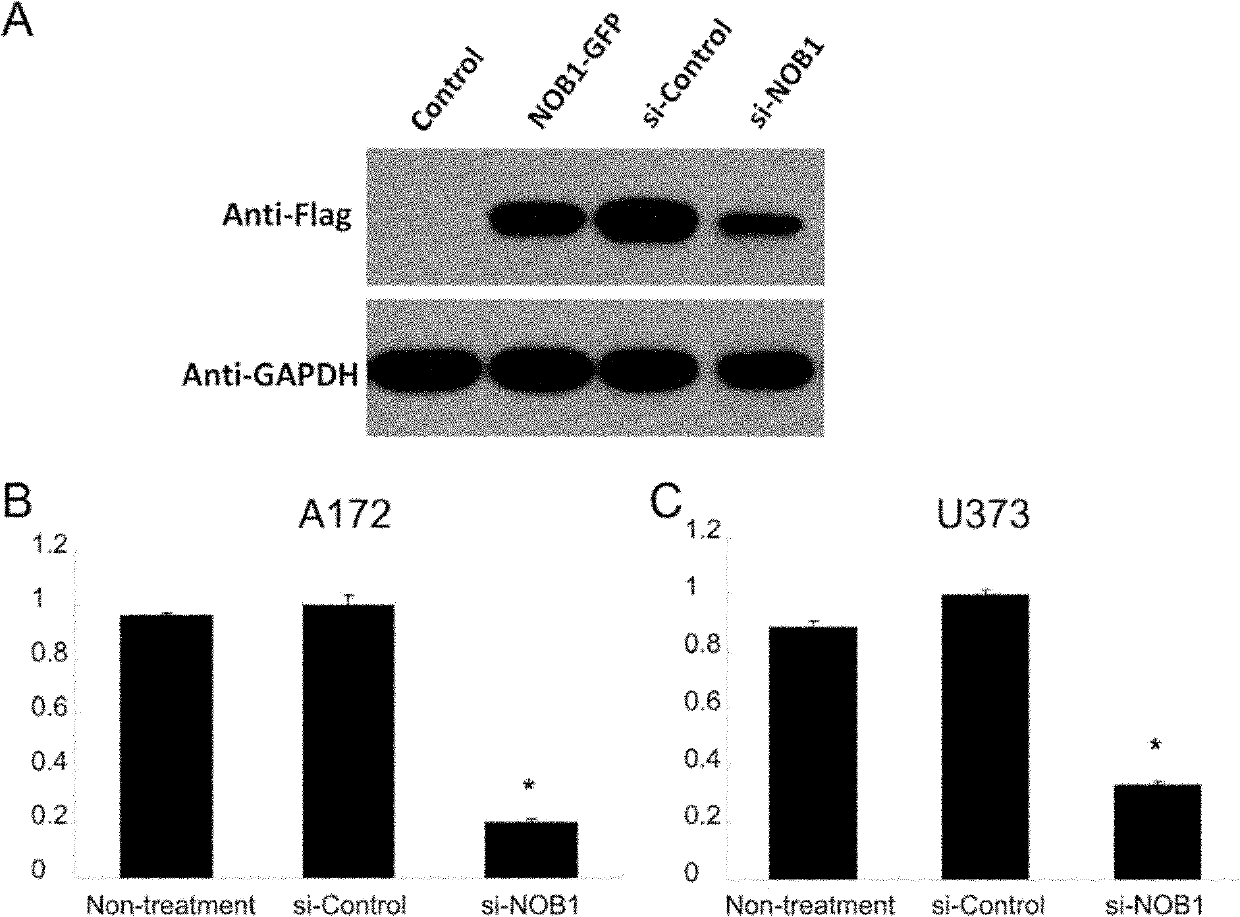 Application of NOB1 gene in treating brain glioma disease