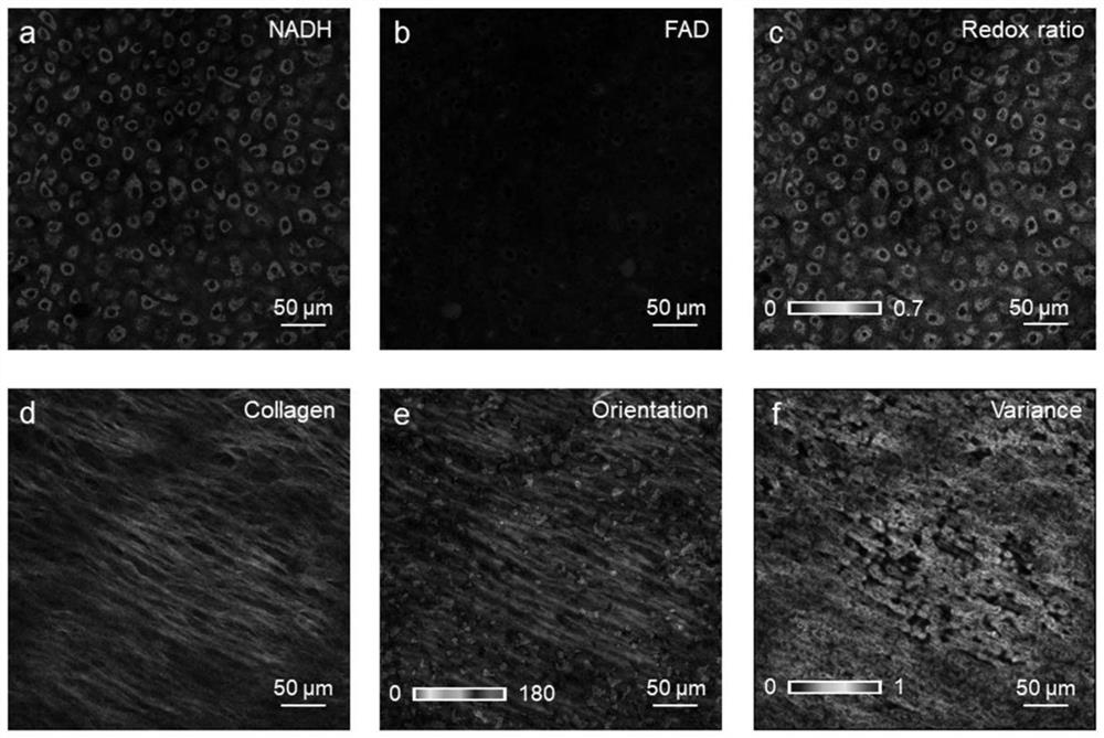 Multi-photon ultra-deep tissue imaging equipment based on coherent detection and detection imaging method thereof