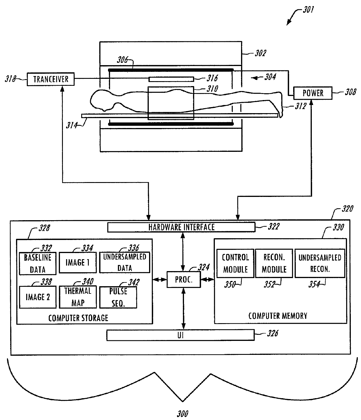 Accelerated MR thermometry mapping involving an image ratio constrained reconstruction