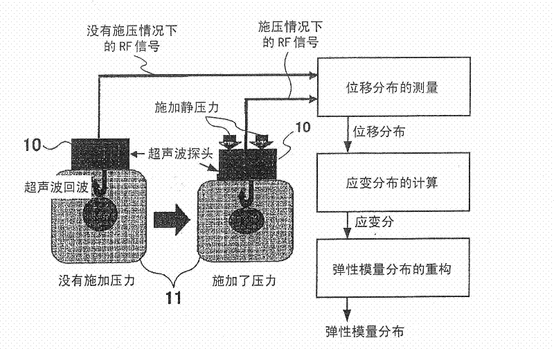 Ultrasonic diagnosis system