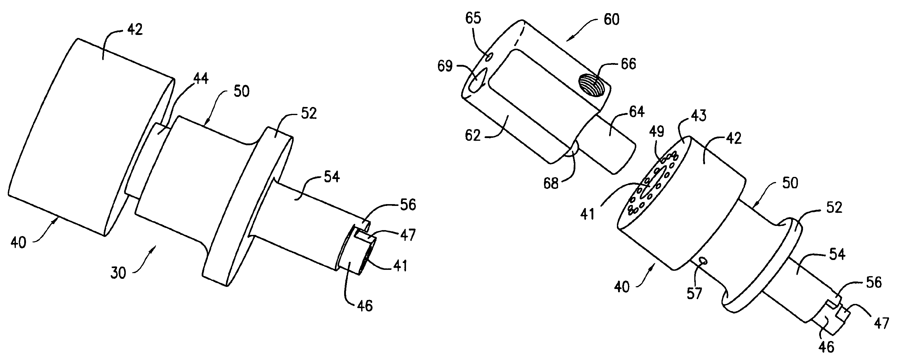 Urethral stent reducer