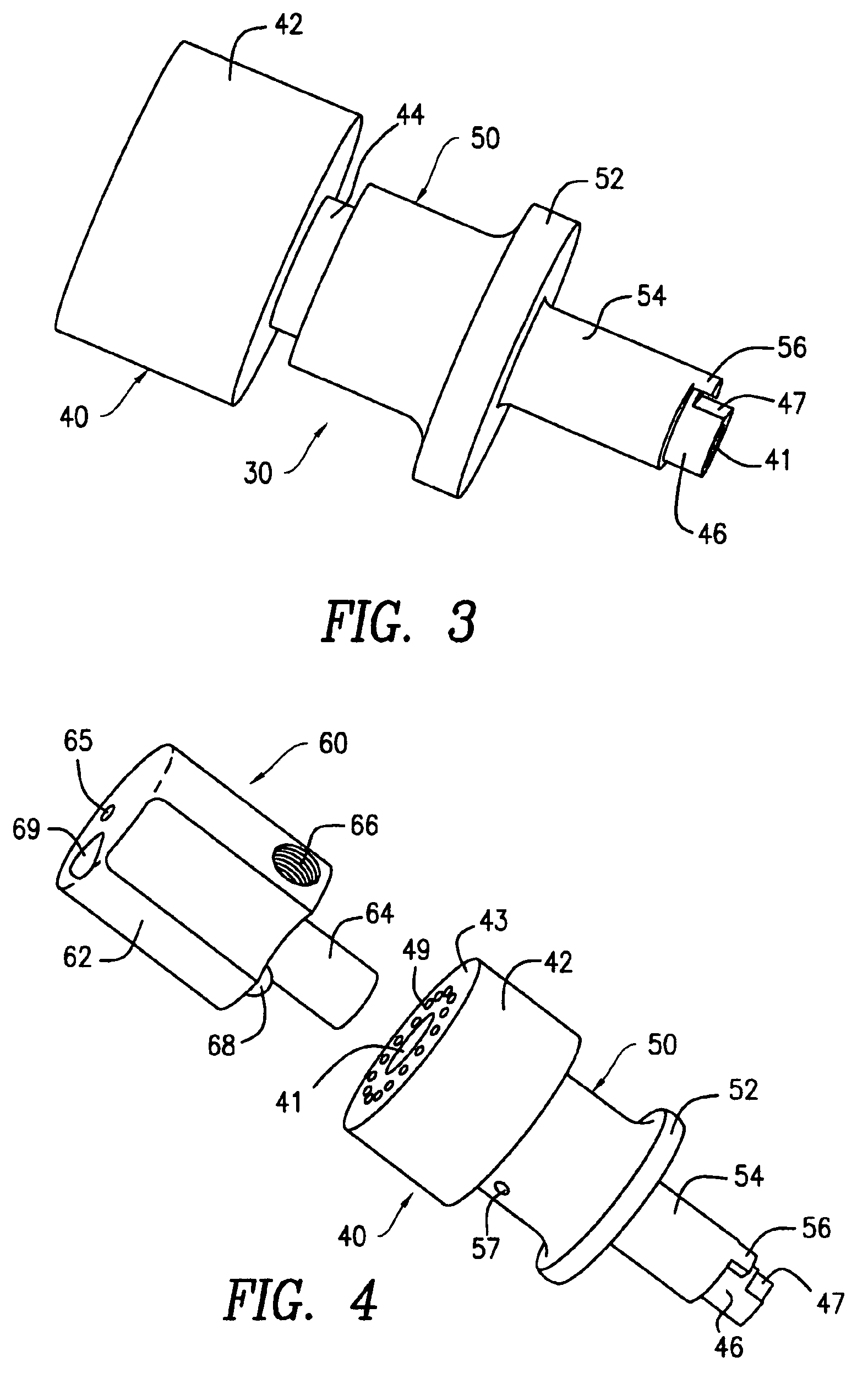 Urethral stent reducer