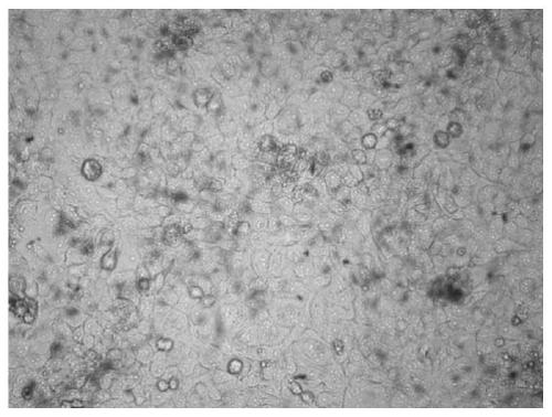 Rapid quantitative senescence cell detection method based on senescence-associated beta-galactosidase