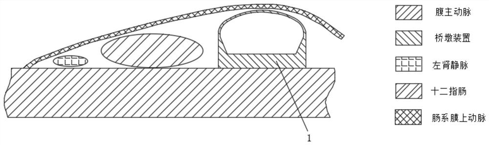 Pump type adjustable mesentery pier device and using method