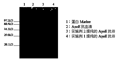 Apolipoprotein E detection kit