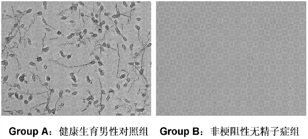 Seminal plasma miRNA marker associated with human non-obstructive azoospermia and application thereof