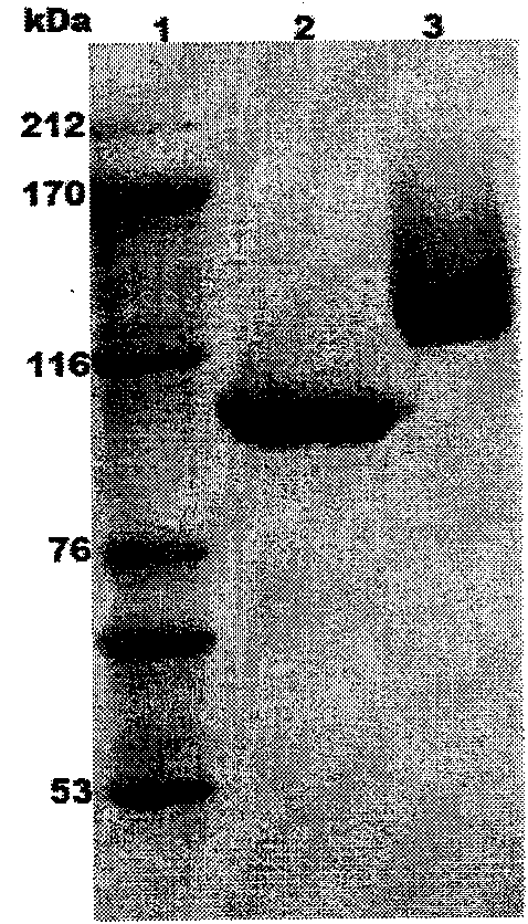 Eosinophilic lactase BGALA, gene and application thereof