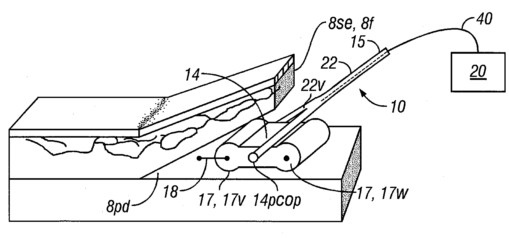 Method and apparatus for surgical dissection