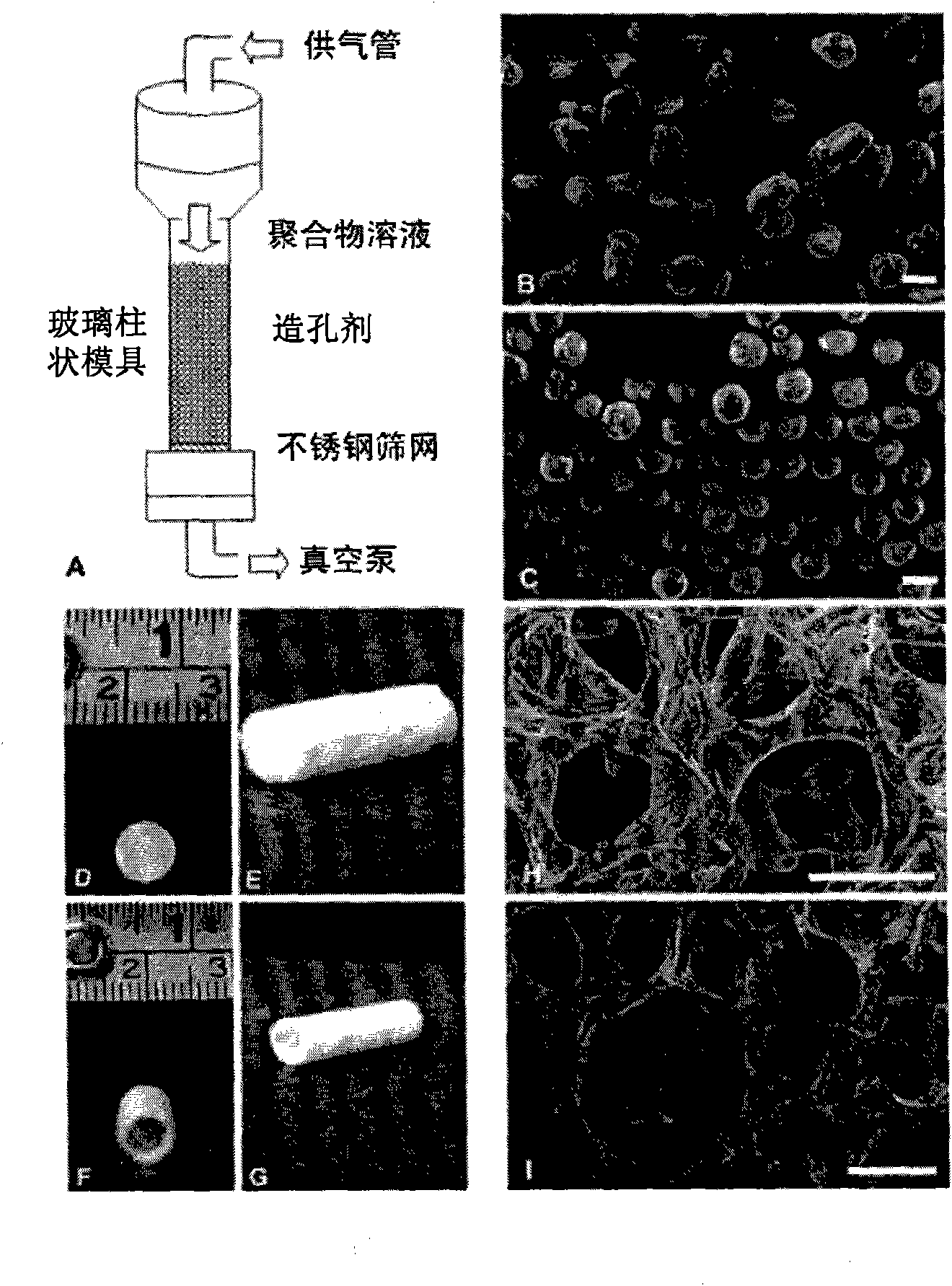 Biomacromolecular hydrogel biological stent and preparation method thereof