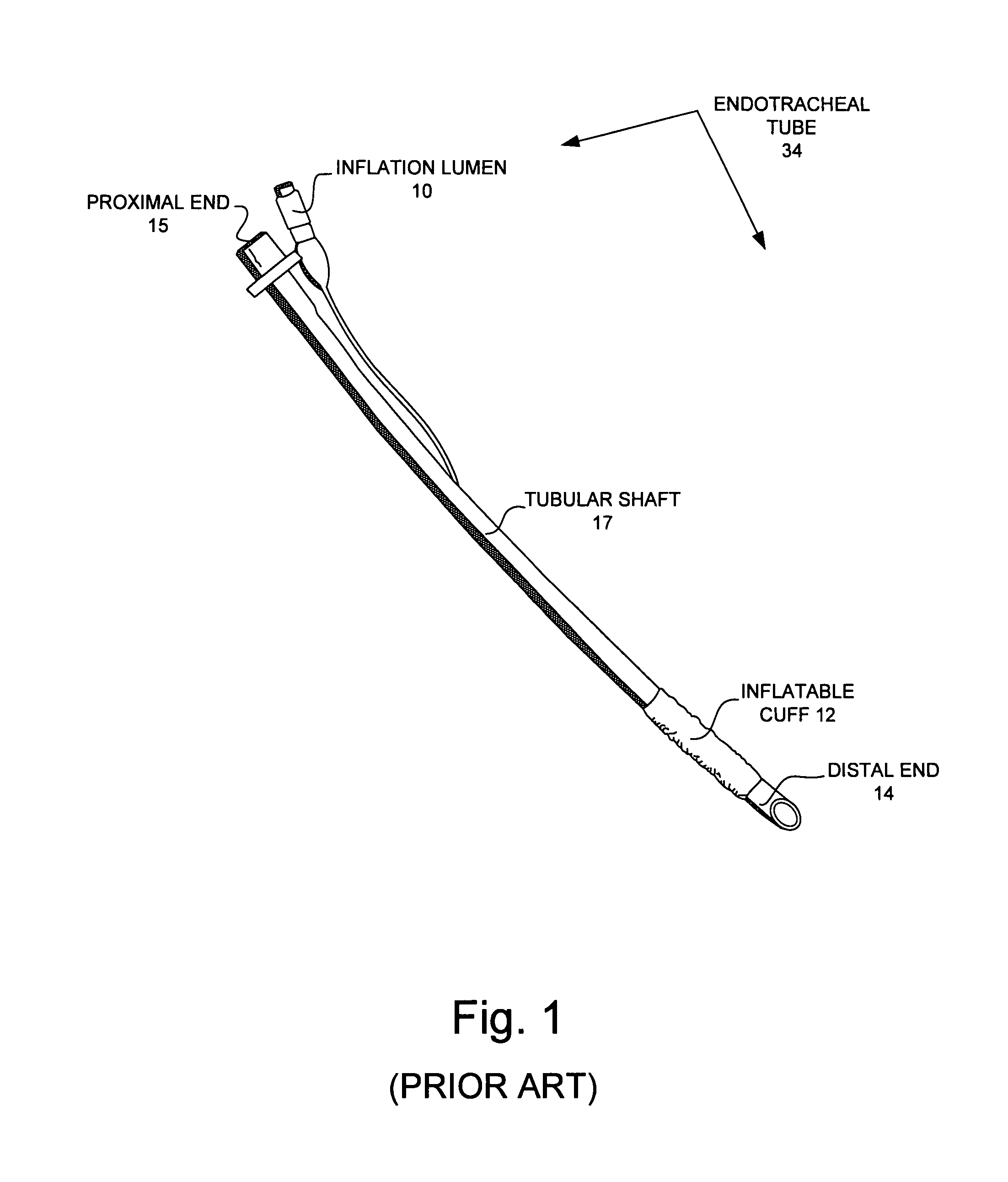 Extendable lighted intubation stylet