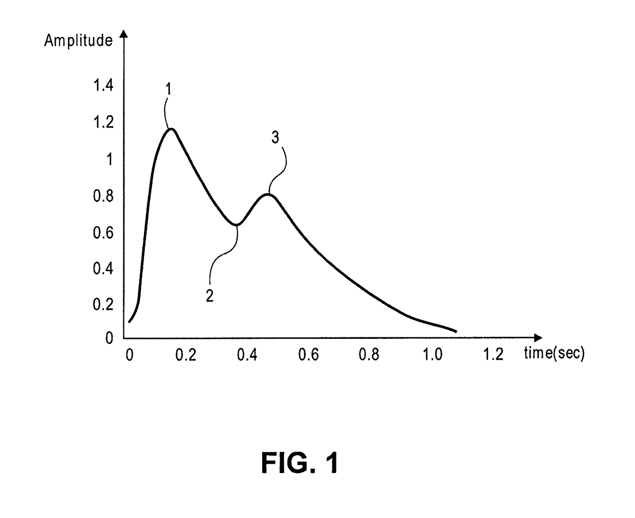 Method and apparatus for real-time non-invasive optical monitoring of decompression sickness state