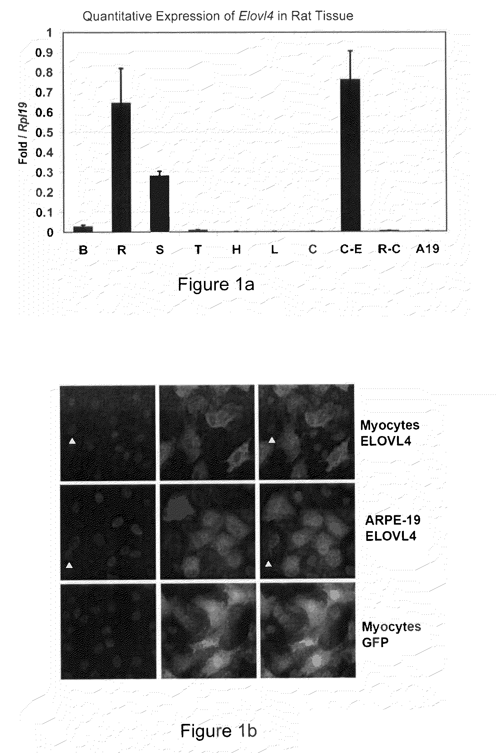 Very long chain polyunsaturated fatty acids, methods of production, and uses