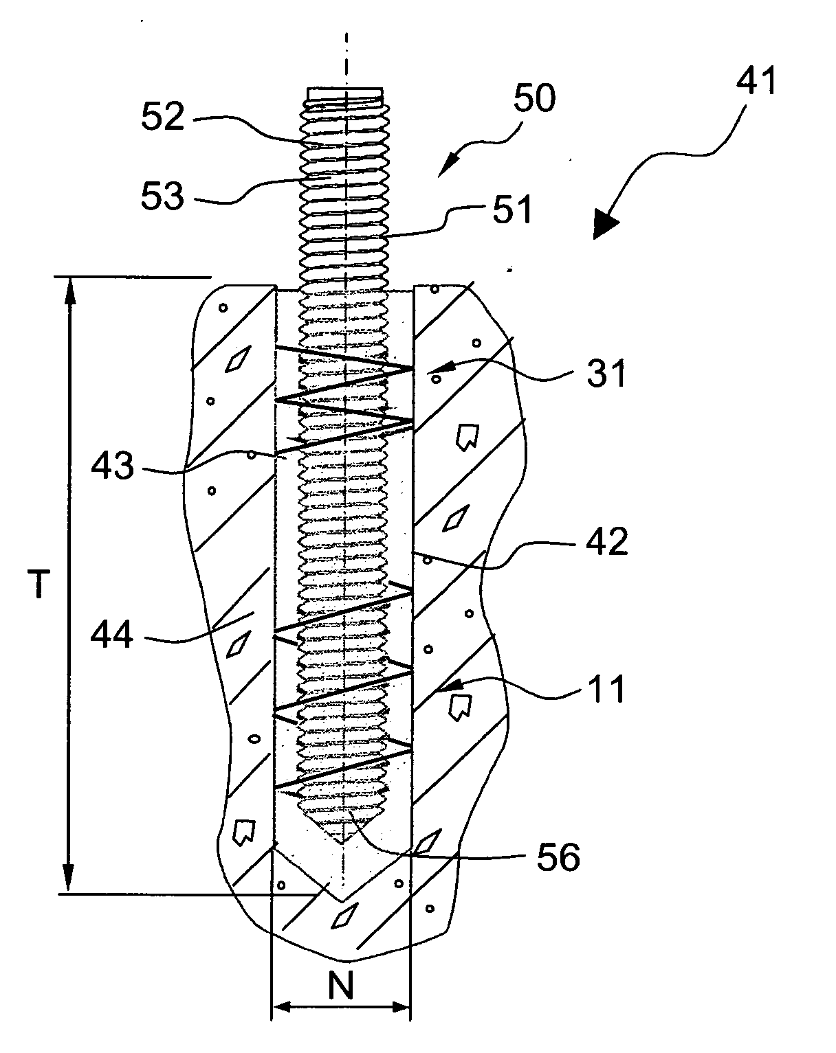 Anchoring Element