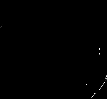 Immobilized 3-phenoxy benzoic acid degrading enzyme and its preparation method