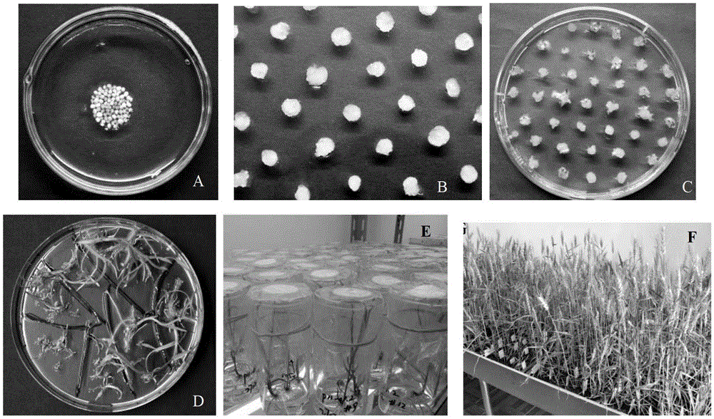 Method for obtaining transgenic wheat by gene gun and its special medium