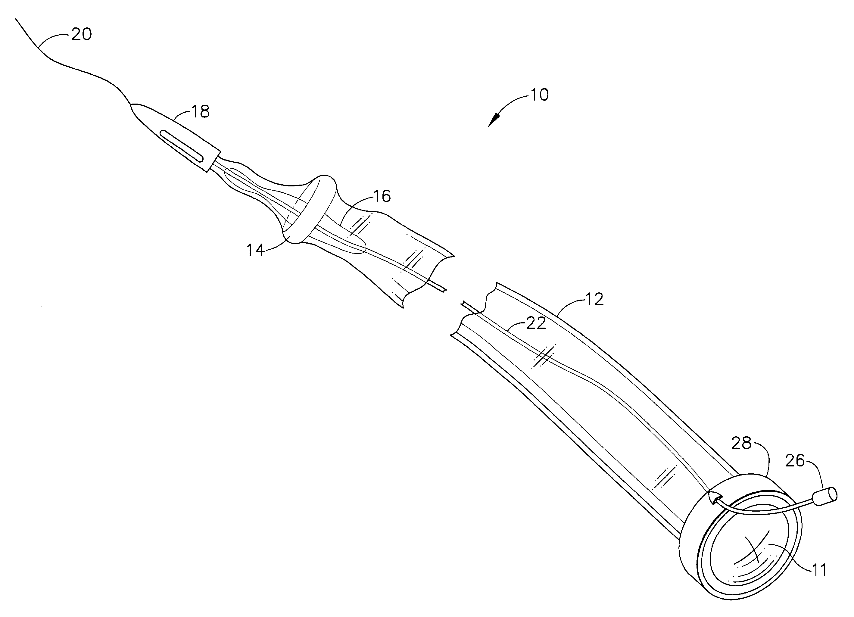 Method for endoscopic, transgastric access into the abdominal cavity