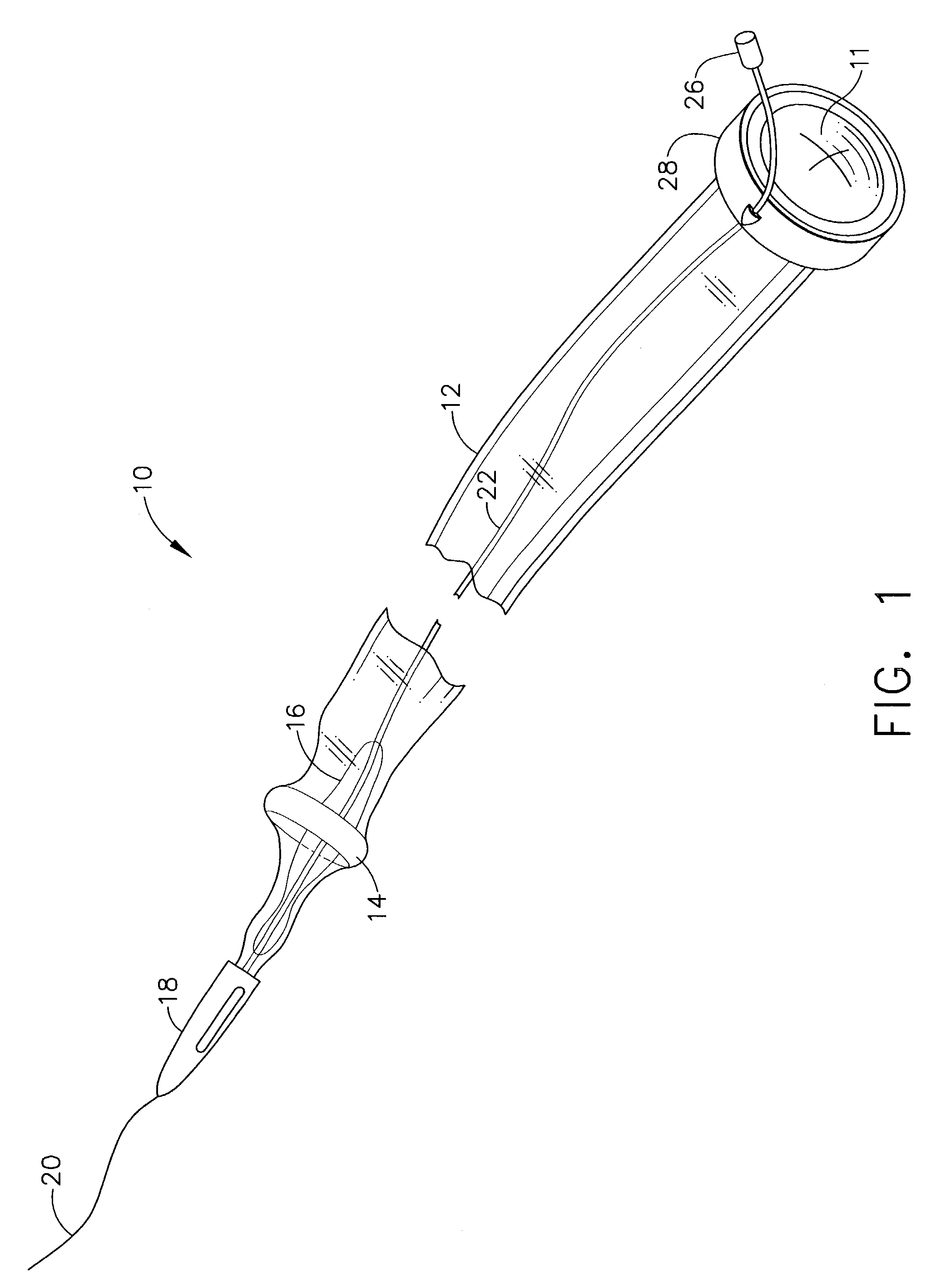 Method for endoscopic, transgastric access into the abdominal cavity