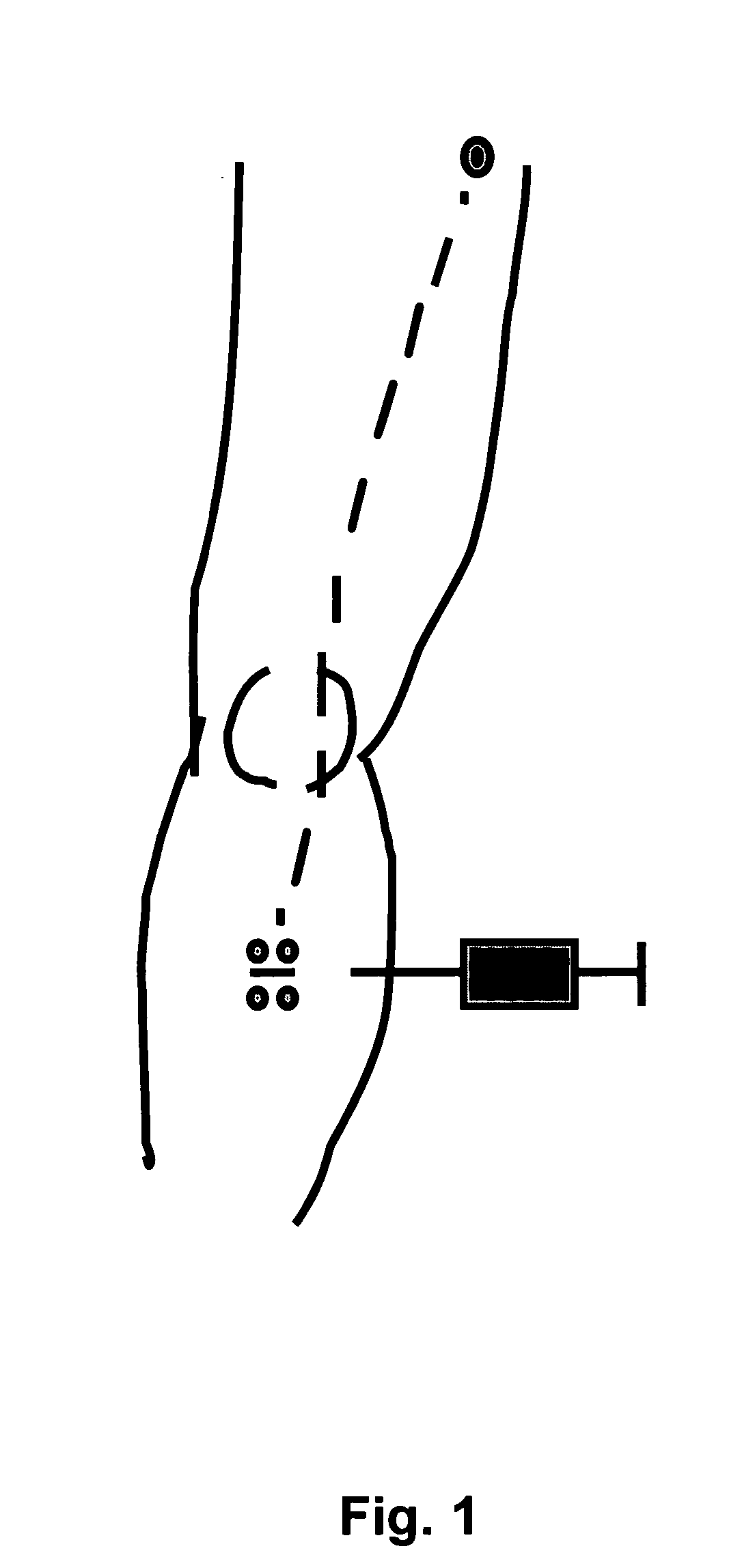 Method for treating malignant melanoma