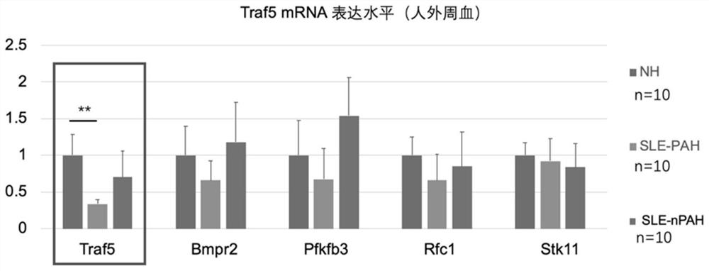 Biomarker for systemic lupus erythematosus combined pulmonary arterial hypertension and application thereof