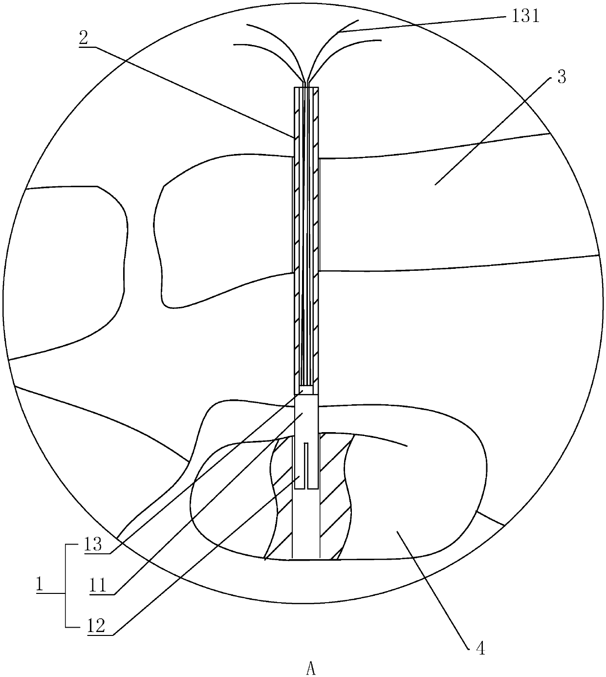 Titanium-nickel memory alloy hook toothed nail for treating acromioclavicular joint dislocation and use method thereof