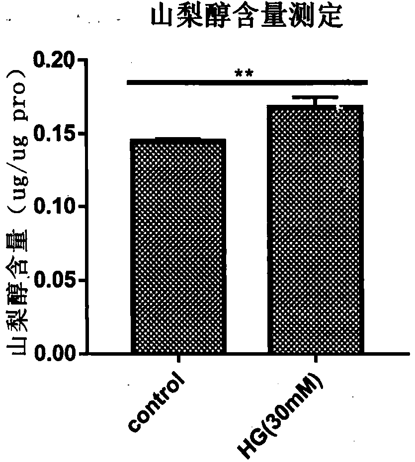 Application of apocynum venetum leaf polyphenol