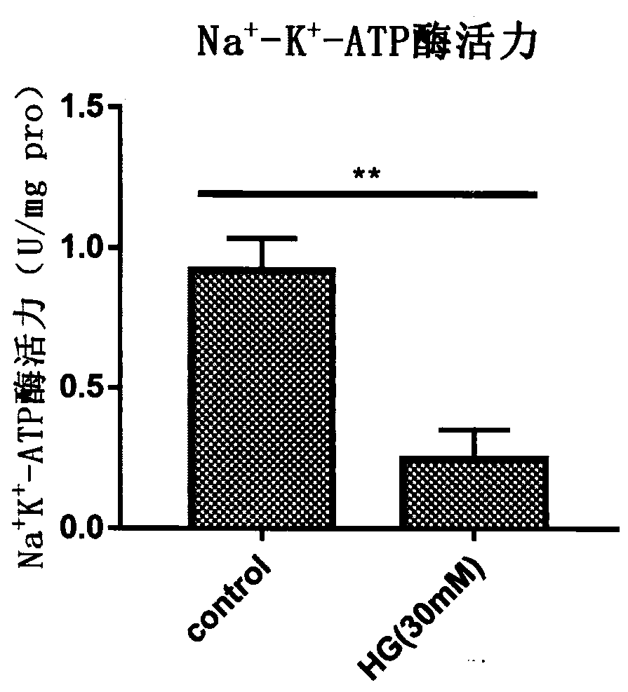 Application of apocynum venetum leaf polyphenol