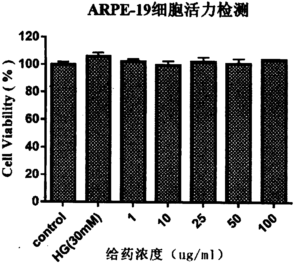 Application of apocynum venetum leaf polyphenol