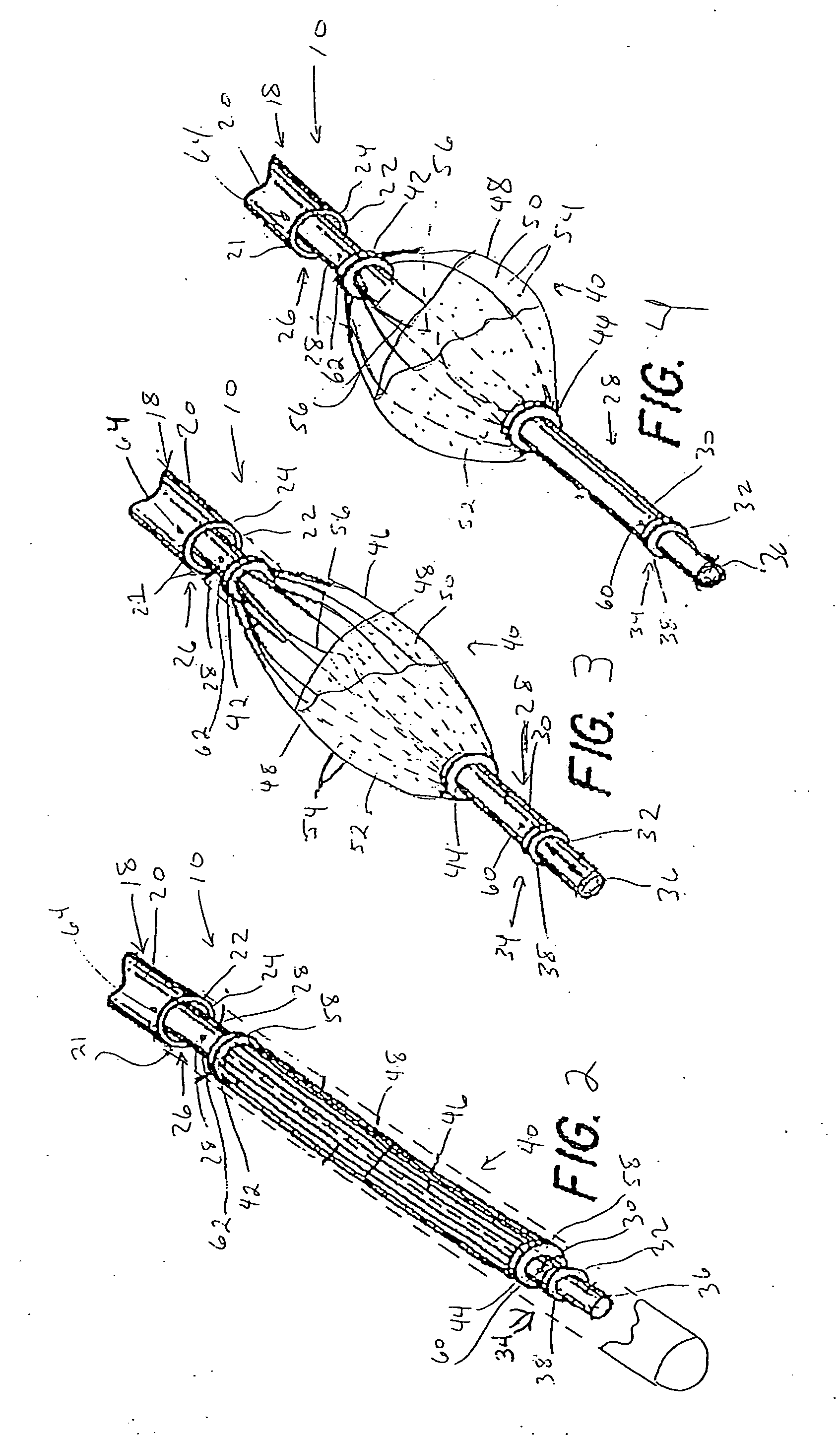 Apparatus for trapping emboli