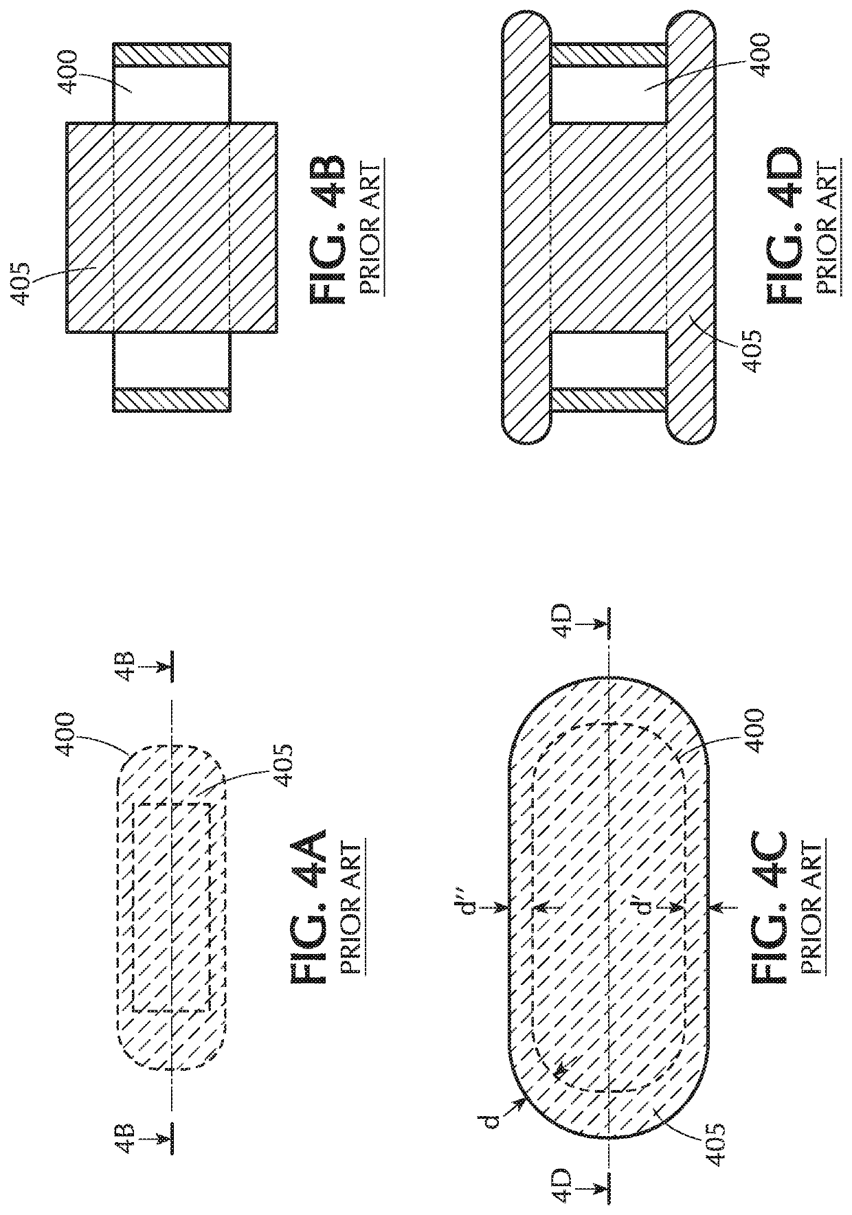 Visibility of Mechanical Thrombectomy Device During Diagnostic Imaging