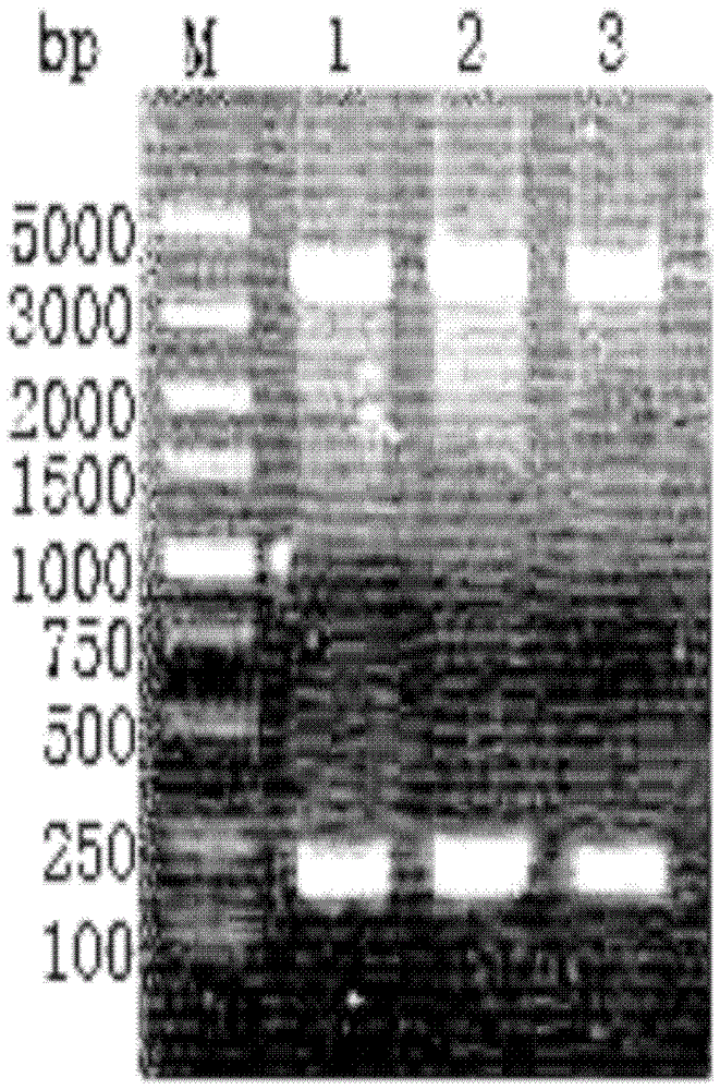 Optimization and high-level expression of insulin aspart precursor gene