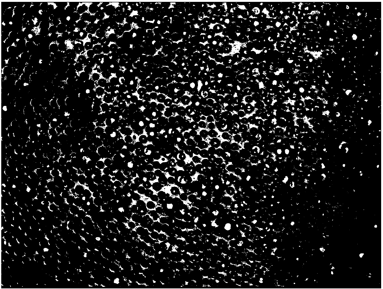 Culture method of colorectal cancer solid tumor primary cells