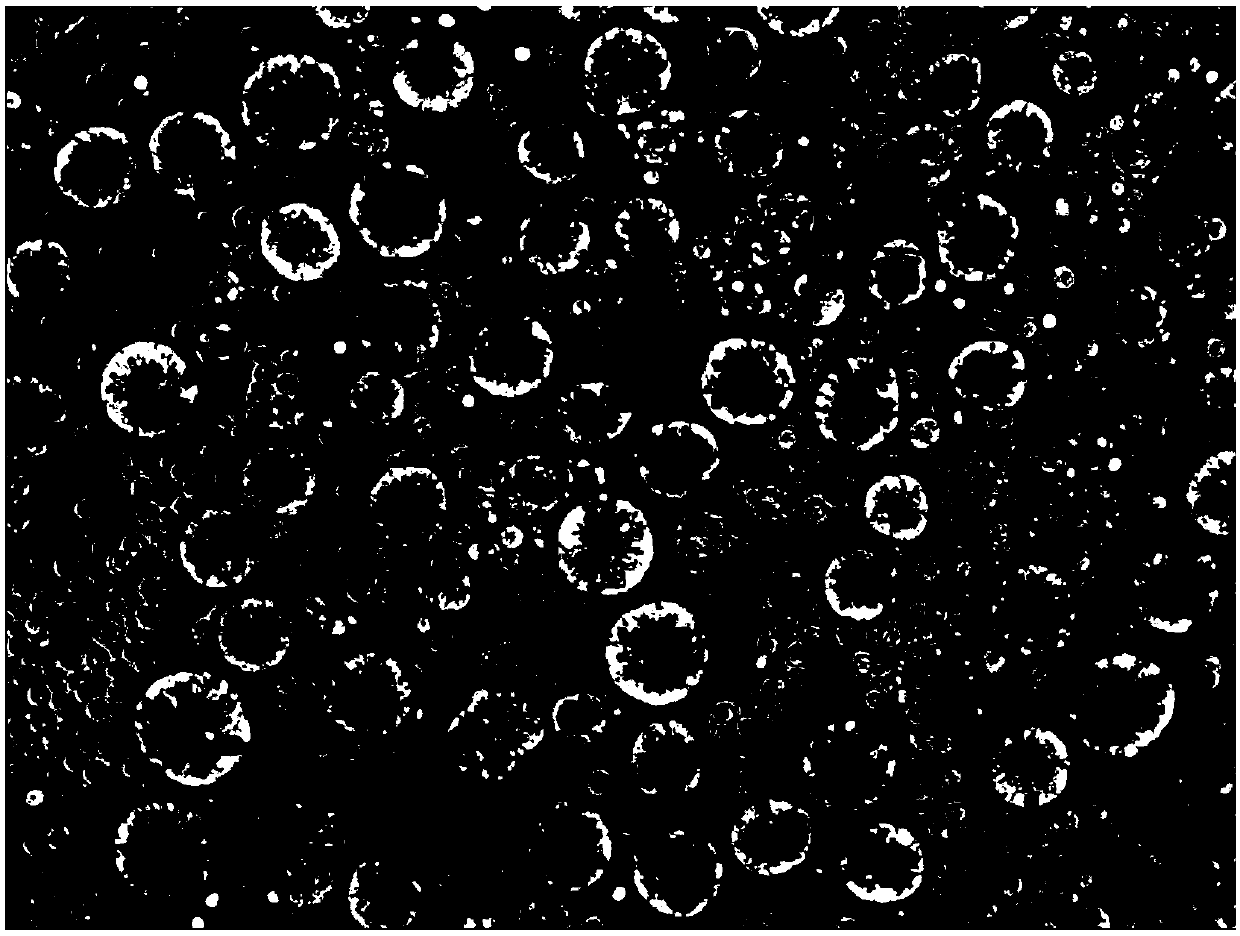 Culture method of colorectal cancer solid tumor primary cells