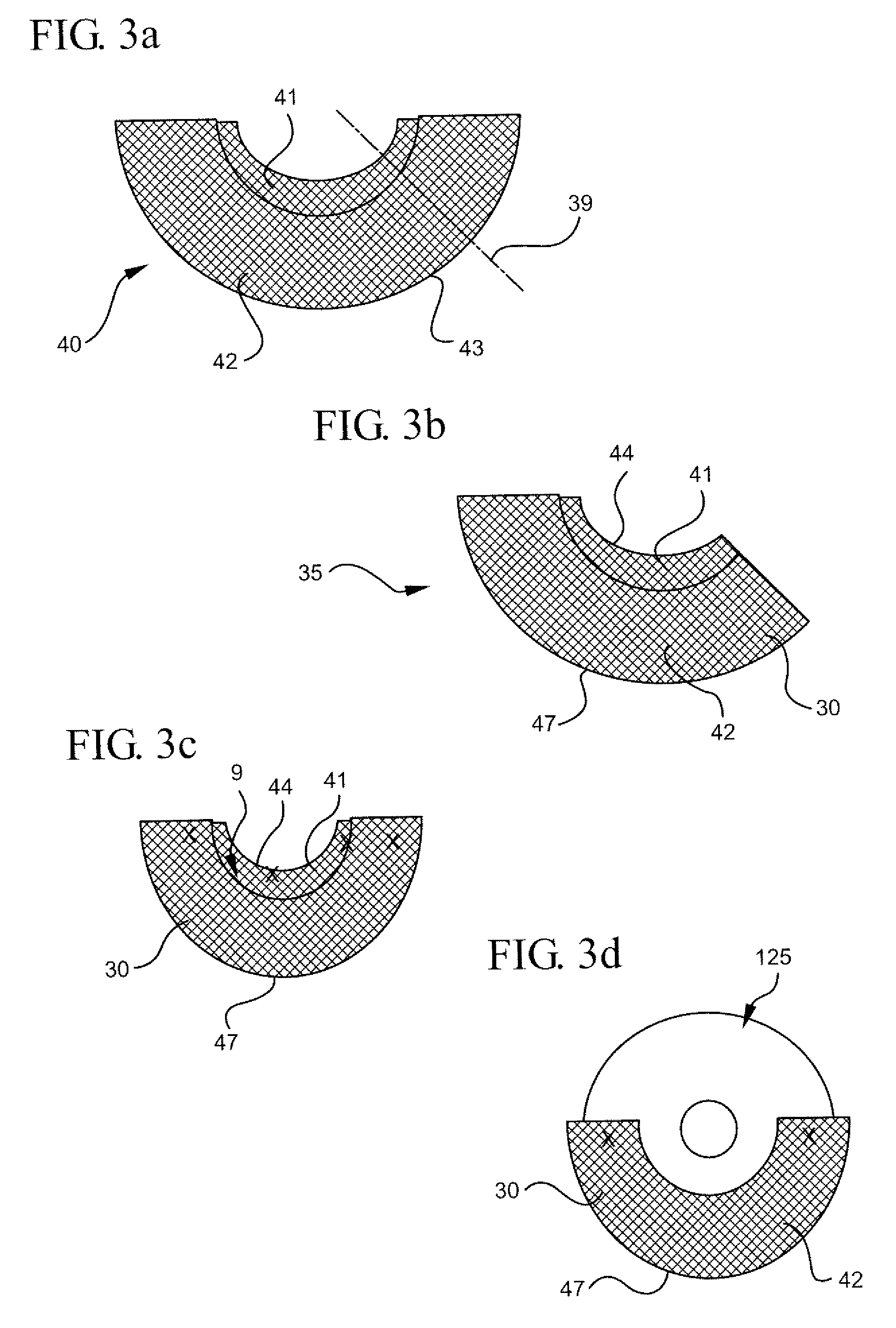 Naturally contoured, preformed, three dimensional mesh device for breast implant support