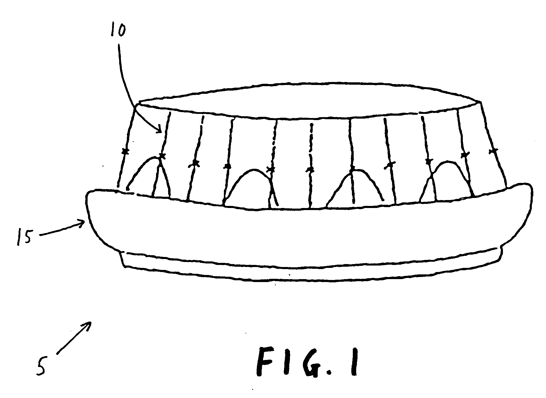 Fixation band for affixing a prosthetic heart valve to tissue