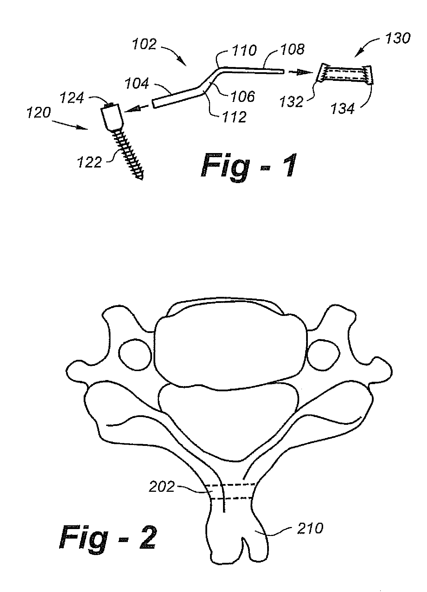 Laminoplasty apparatus and methods