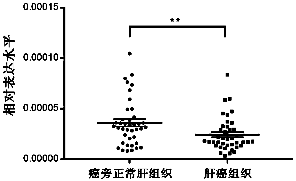 miRNA marker related to liver cancer sorafenib resistance and application of miRNA marker