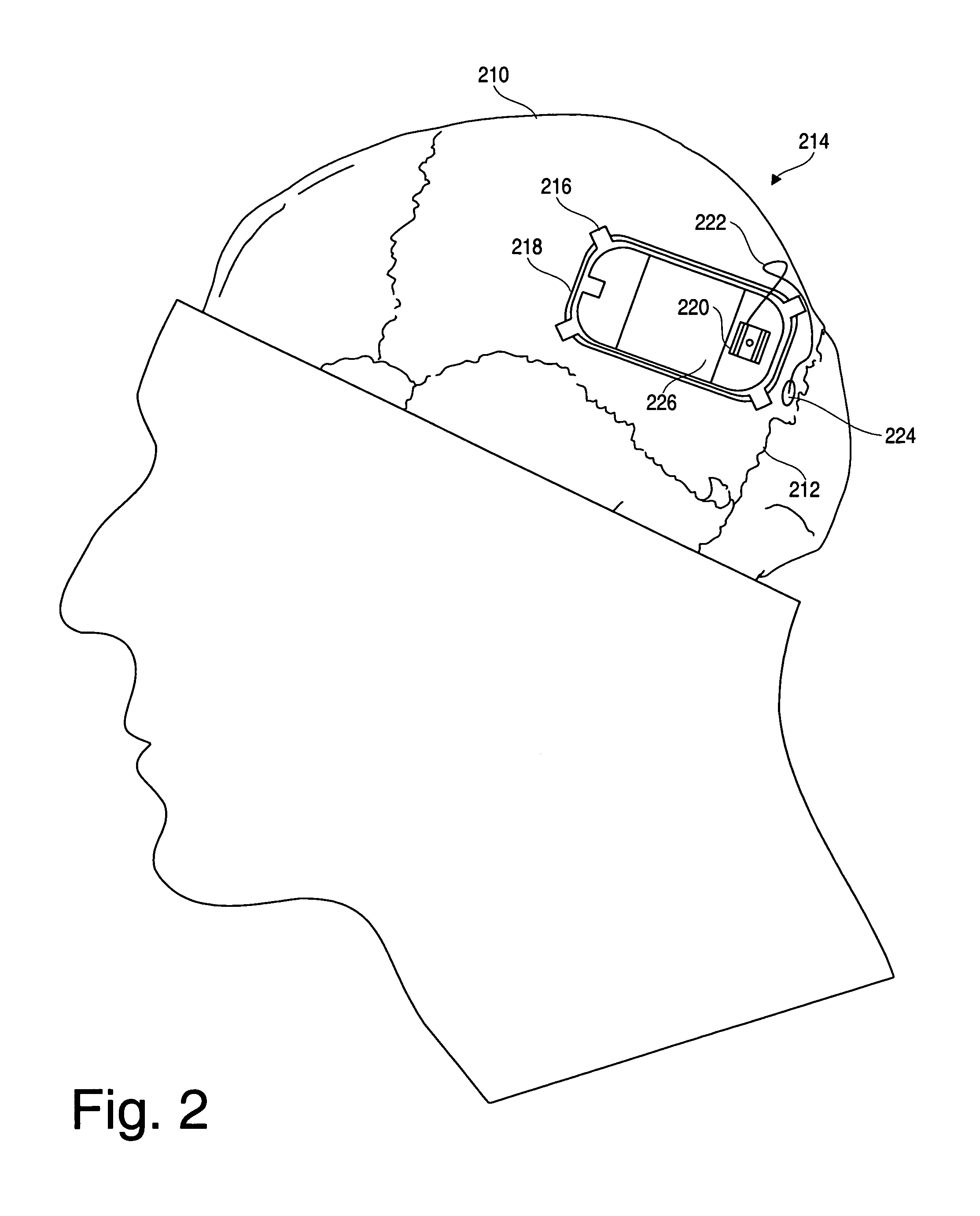 Predicting susceptibility to neurological dysfunction based on measured neural electrophysiology