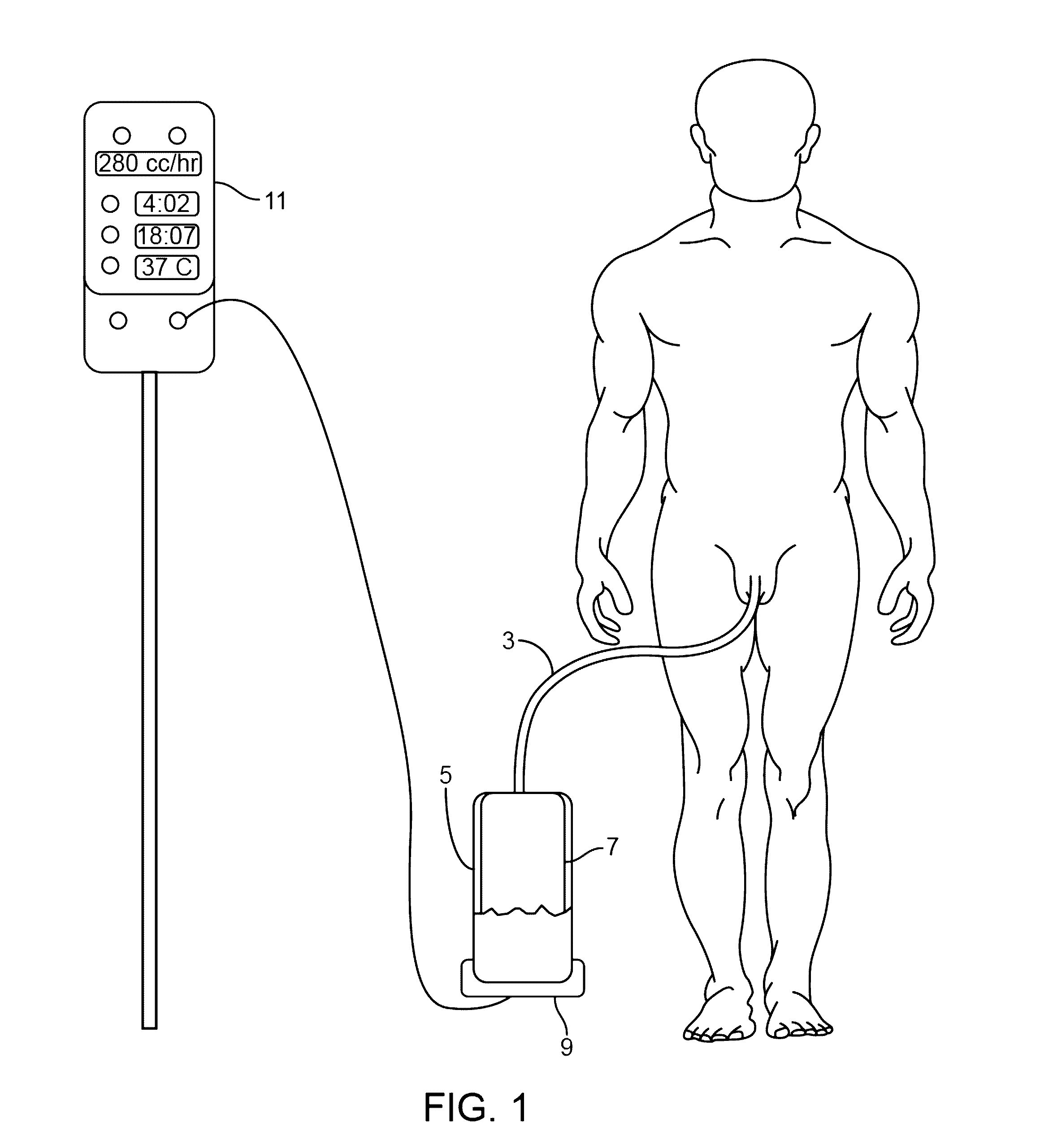 Systems, devices and methods for draining and analyzing bodily fluids