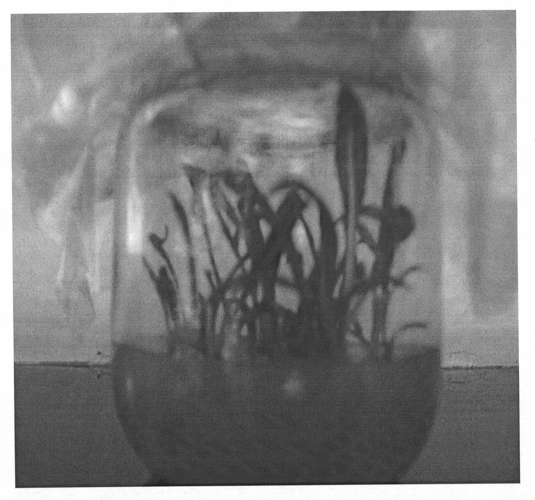 Separation and culturing method of saussurea involucrate protoplast