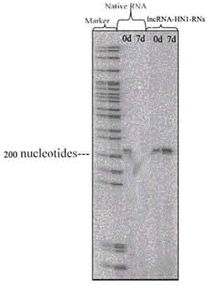 Preparation and application of long non-coding RNA (ribonucleic acid) nanometer microsphere