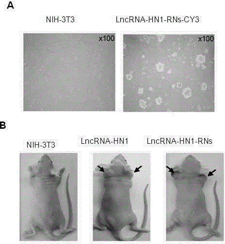 Preparation and application of long non-coding RNA (ribonucleic acid) nanometer microsphere