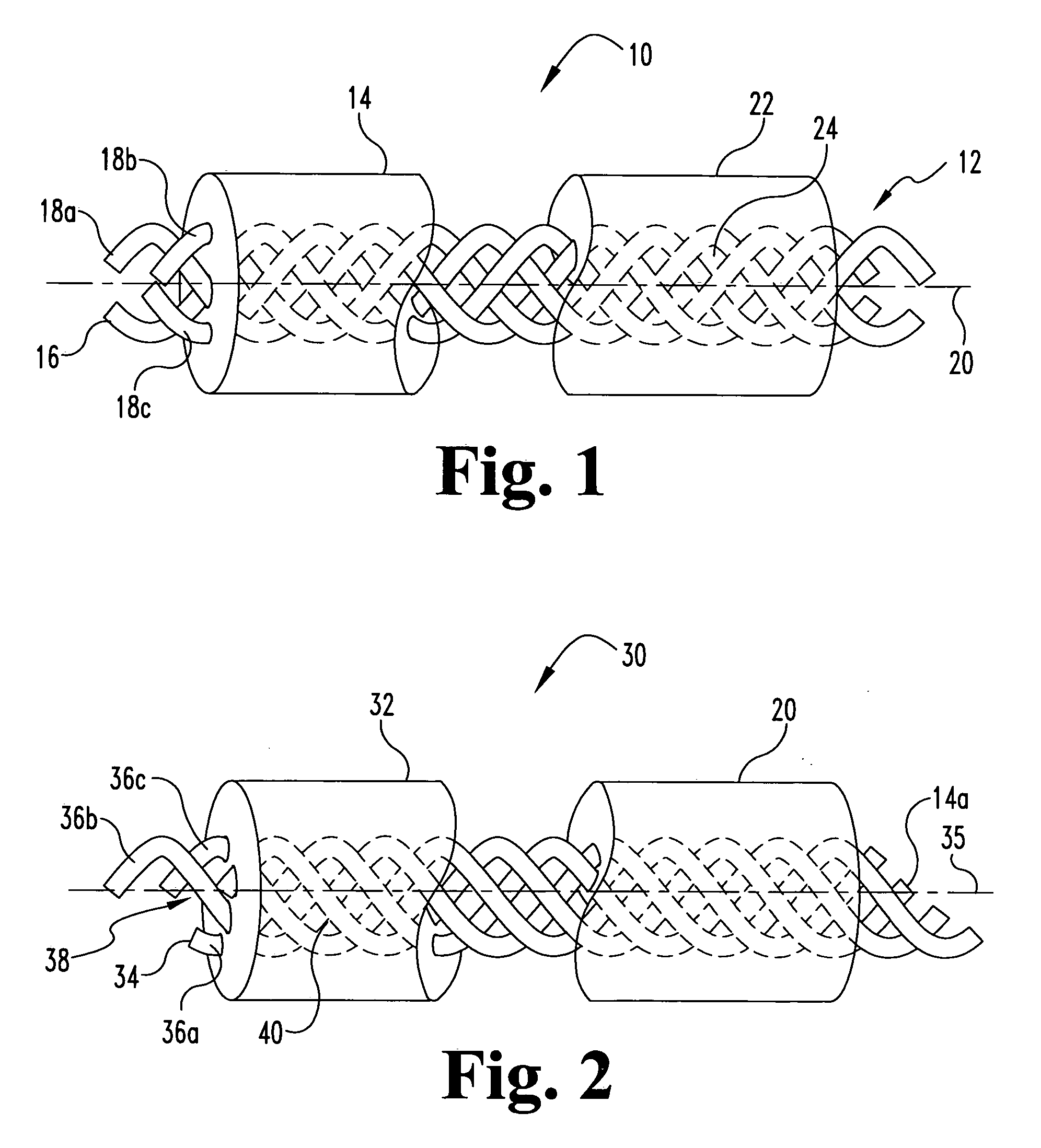 Designed composite degradation for spinal implants