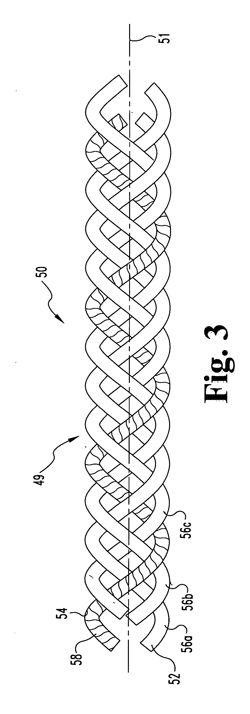 Designed composite degradation for spinal implants