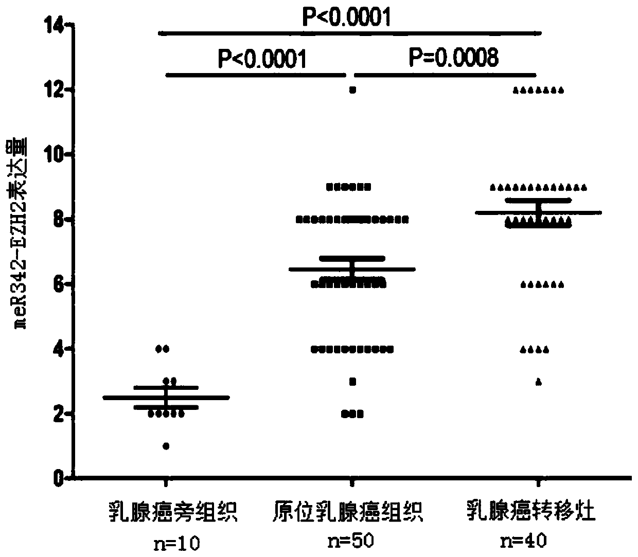 Biomarker for breast cancer metastasis and prognosis diagnosis