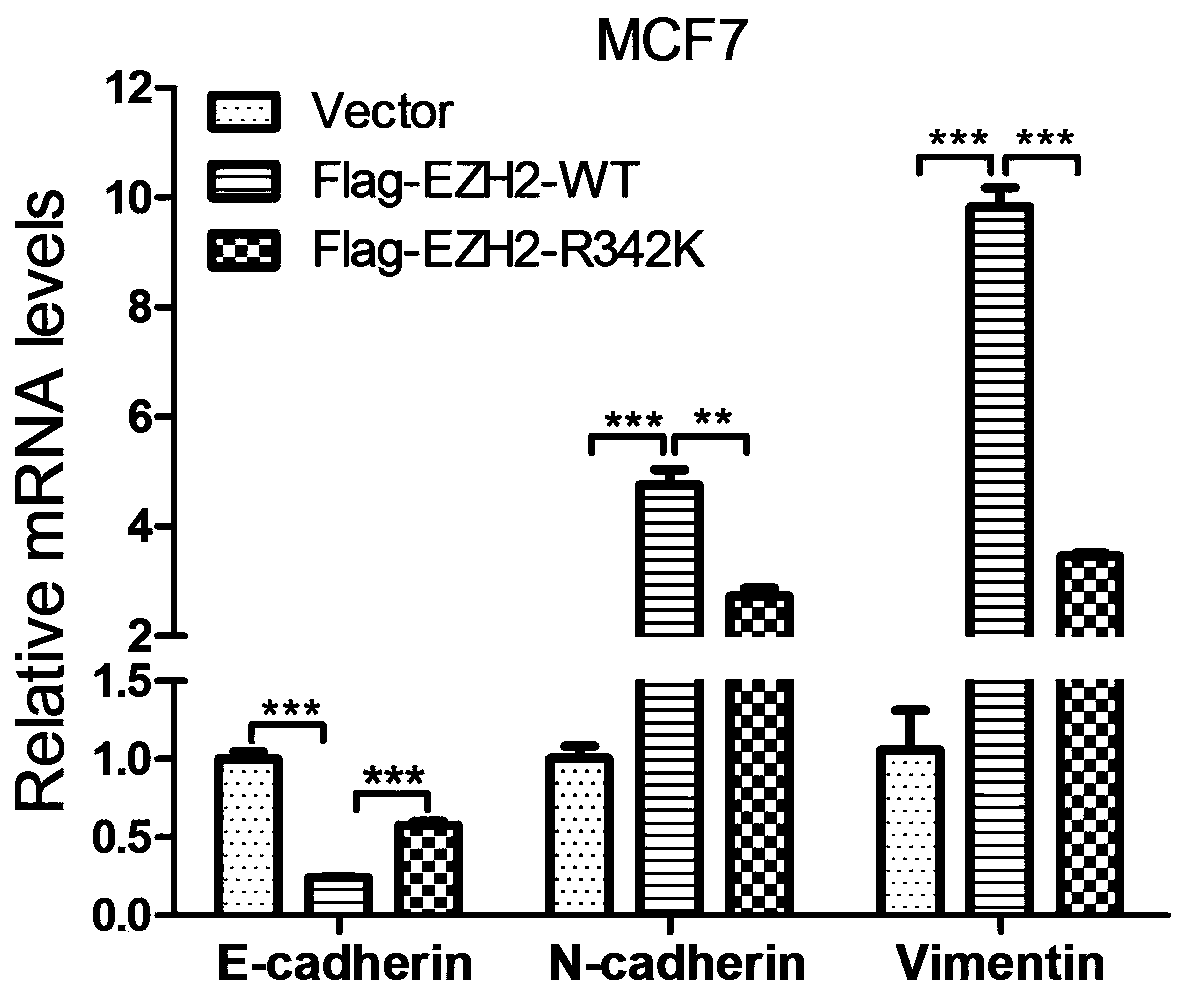 Biomarker for breast cancer metastasis and prognosis diagnosis