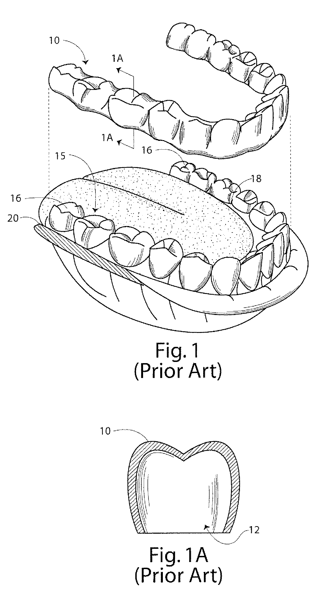 Method for Repositioning Teeth