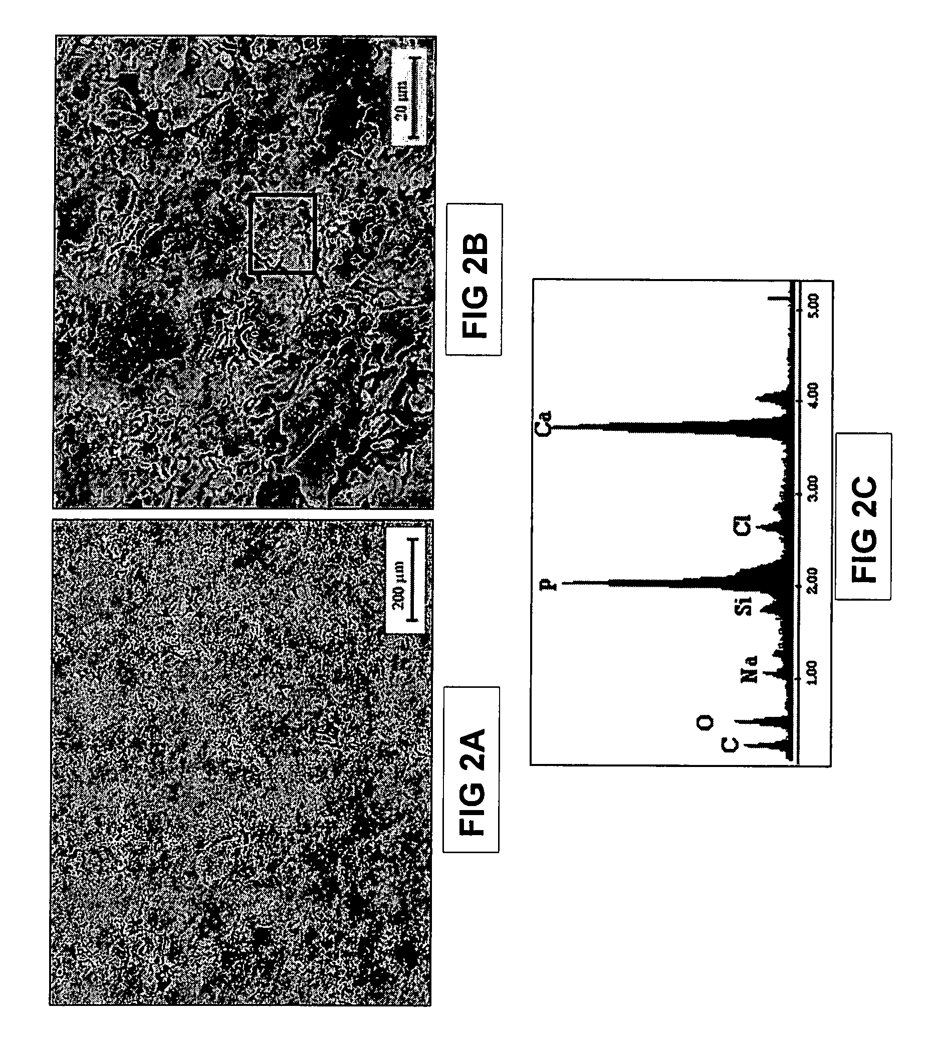 Bioactive load-bearing composites