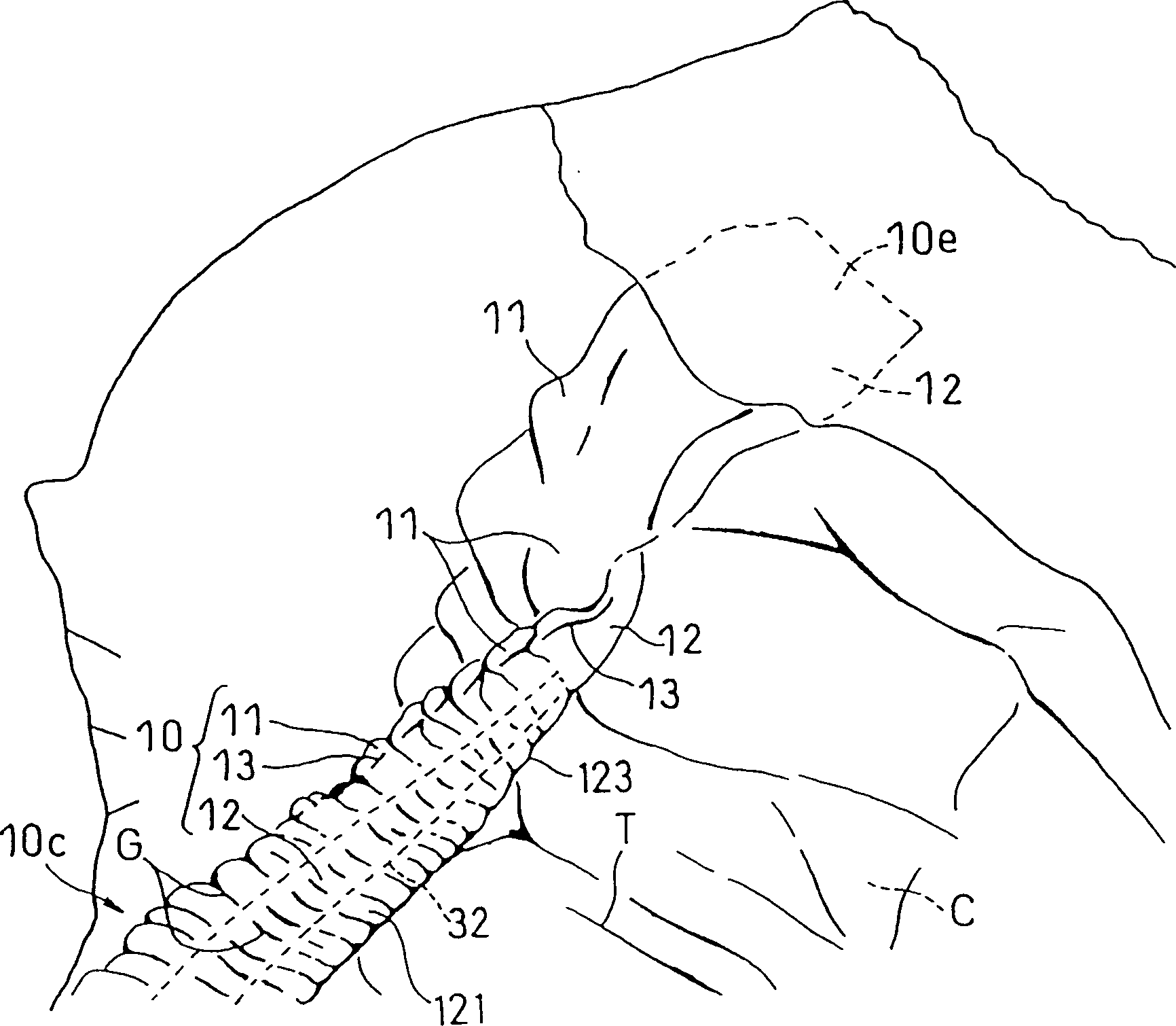 Disposable absorbent wearing article