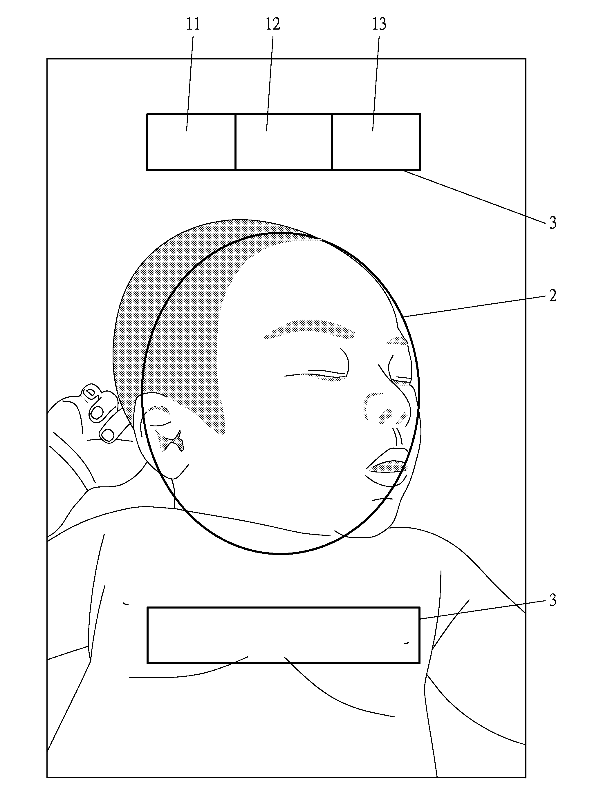 Self-Diagnostic Method for Jaundice and an APP Product Thereby