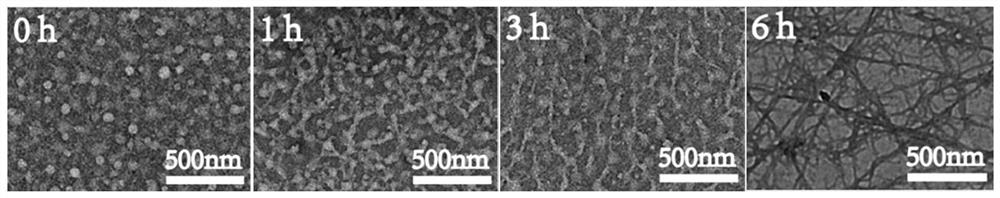 Nanoparticle compound with tumor microenvironment responsive deformation